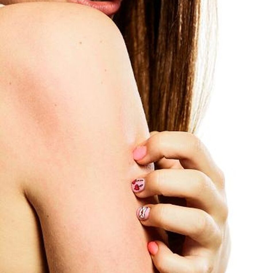 Picazón: ¿un simple síntoma cutáneo?