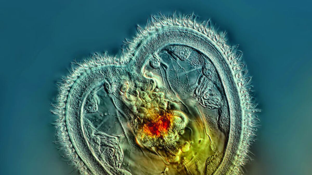 Imagen ‘Rotífero mostrando detalles internos de la boca y la corona con forma de corazón’, triunfadora del Nikon Small World 2014. CORTESÍA