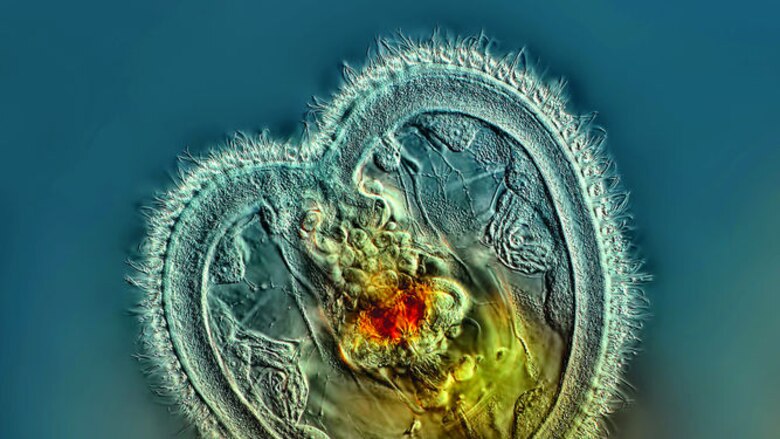 El arte de la fotomicrografía