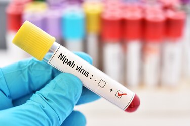 El virus de nipah: cómo se transmite, síntomas y origen