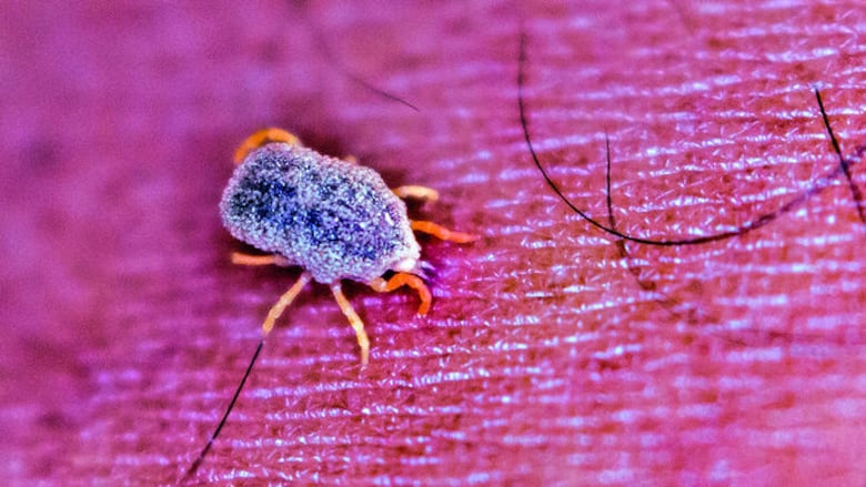 Garrapatas, en el contexto de la salud