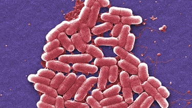 Hallan por primera vez en Estados Unidos una bacteria 'multirresistente'