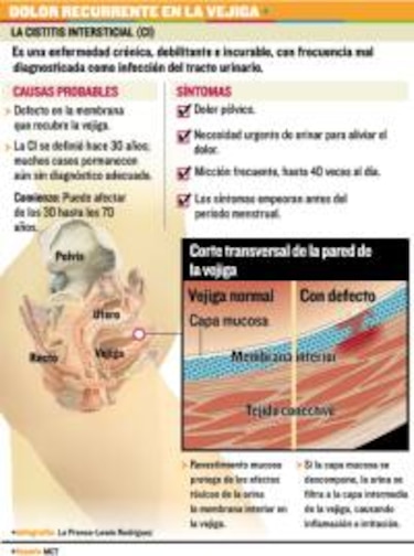 Infección en la ‘luna de miel’
