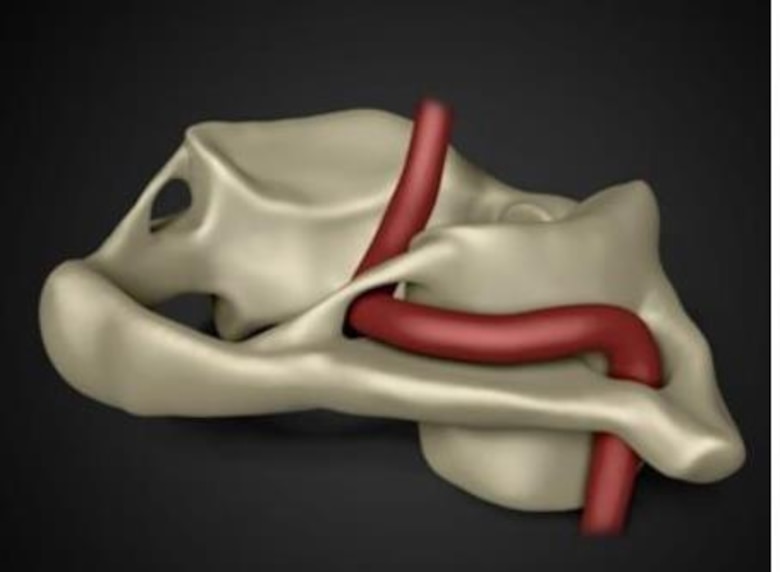 Mordida disfuncional: causa de algunas enfermedades de origen desconocido, donde aplica