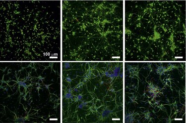 Crean un biomaterial con interés potencial para recuperar los daños en la médula espinal