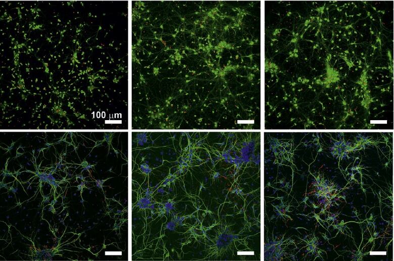 Crean un biomaterial con interés potencial para recuperar los daños en la médula espinal