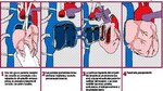 Se buscan héroes de órganos y tejidos