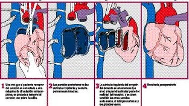 Se buscan héroes de órganos y tejidos