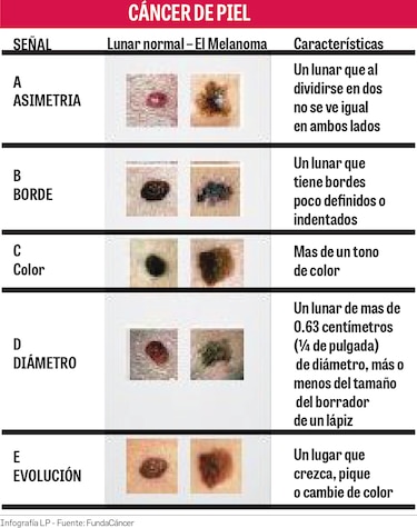 Unidos para detectar cáncer de piel