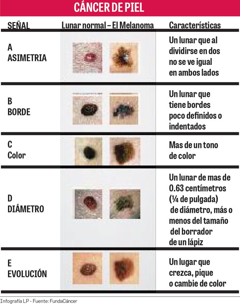 Unidos para detectar cáncer de piel