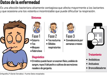 CSS brinda consejos para evitar brotes de tosferina