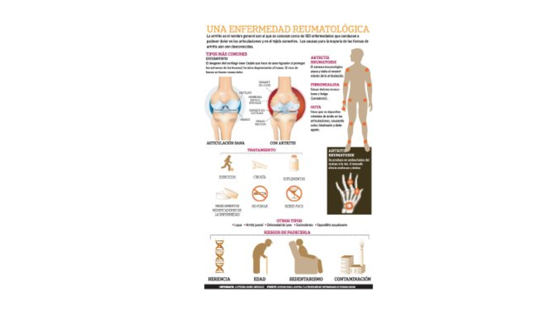 Los órganos que impacta la artritis