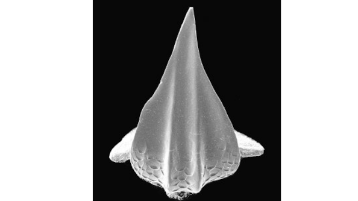 Imágenes de microscopio electrónico de barrido de dentículos de diferentes especies de tiburones: 1. ‘Mustelus canis’ (200x), 2.