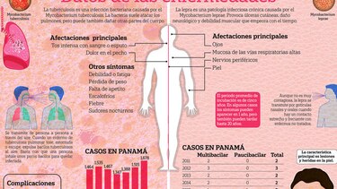 Lepra y tuberculosis, aún activas