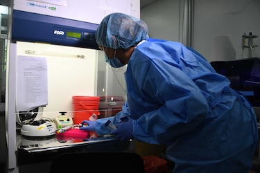 Cifra de casos activos de la Covid-19 asciende a 1,918, se reportan 2 defunciones en las últimas horas