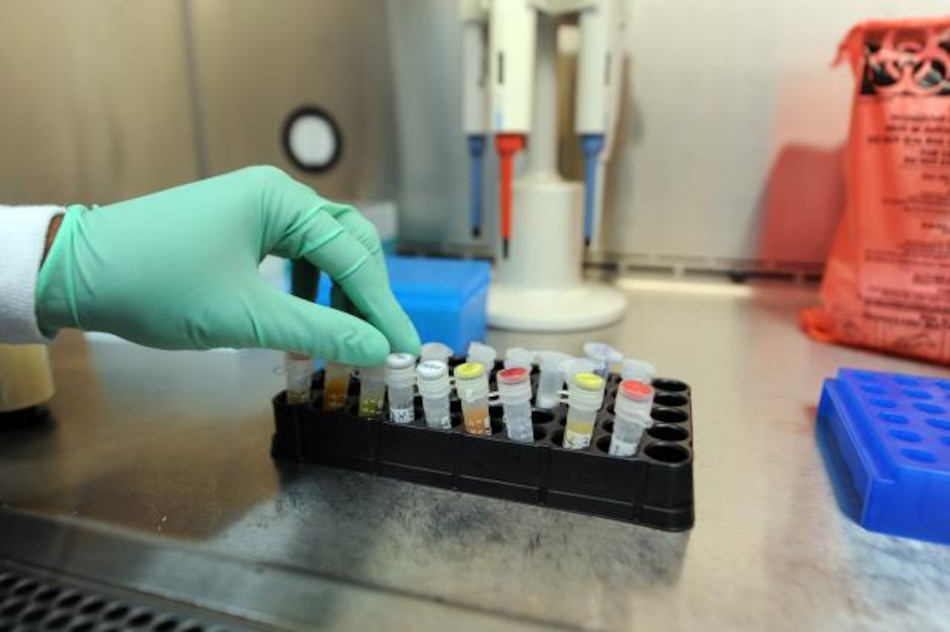 Un hospital de España probará una vacuna terapéutica contra el sida