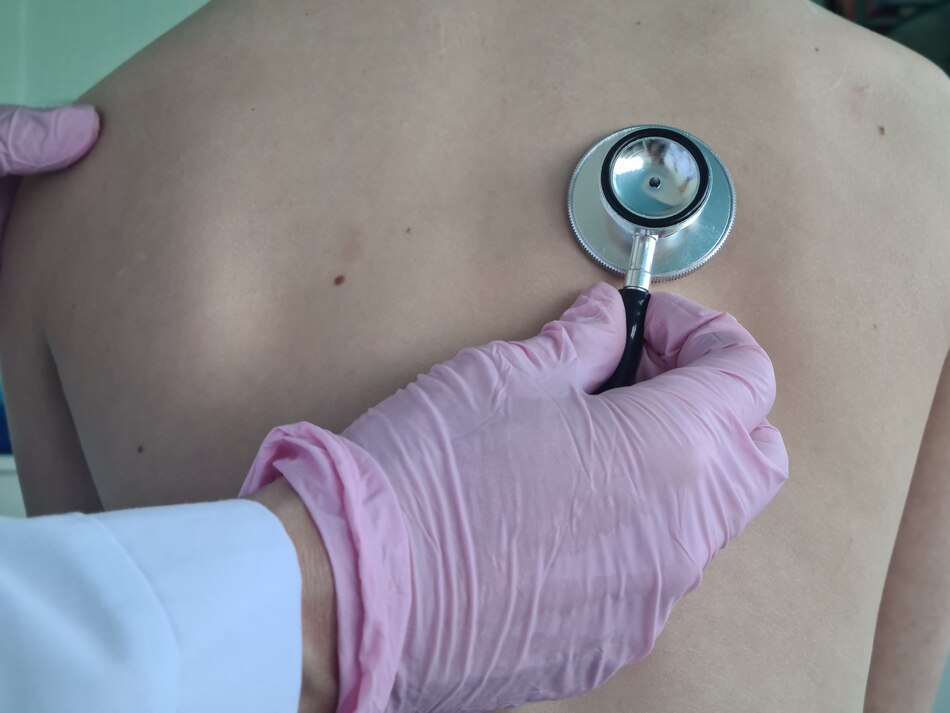 Lo que debe saber sobre el virus parainfluenza humano tipo 4 en Panamá