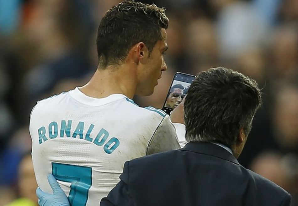 Video: Corte de Cristiano Ronaldo pudo ser más grave