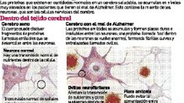 En los intrincados rincones del cerebro