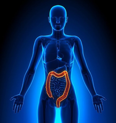 4 mitos del cáncer colorrectal