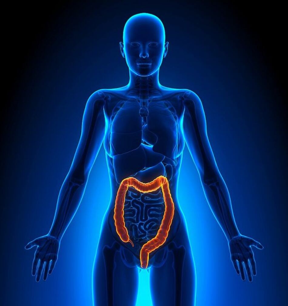 4 mitos del cáncer colorrectal