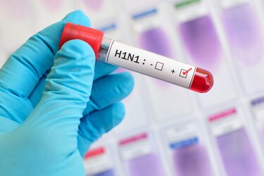 ¿Qué cepas de influenza afectan a Panamá?