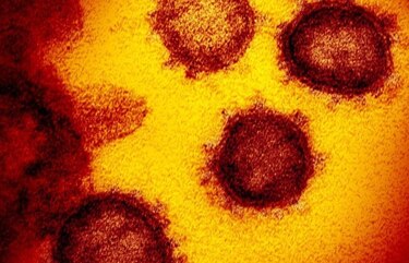 Brasil confirma caso de coronavirus, el primero en Latinoamérica