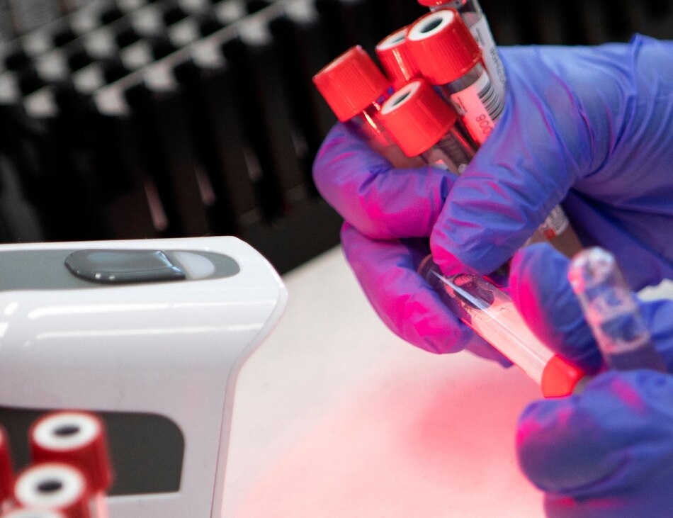 Se descarta relación entre hepatitis infantil y vacunación contra la covid-19