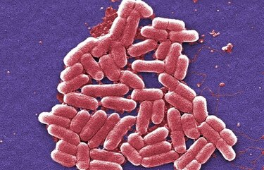 Bacteria superresistente moviliza a autoridades sanitarias de EU