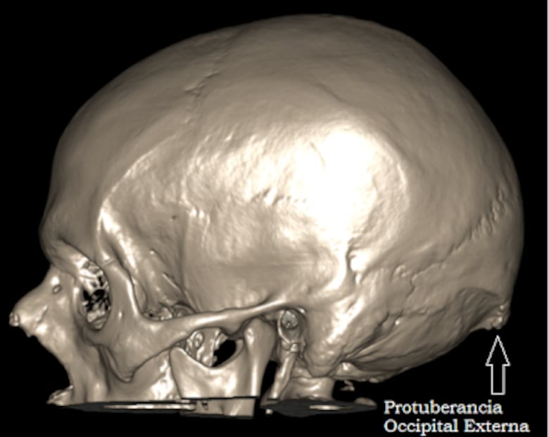 Tu teléfono podría estar dañando tu columna; descubre qué es el síndrome del cuello roto